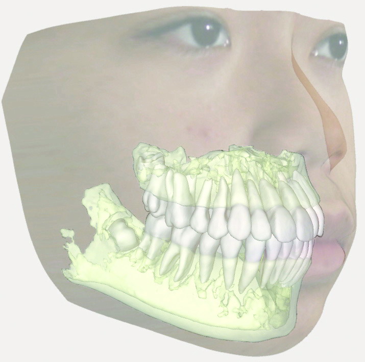 Dental Cone Beam CT